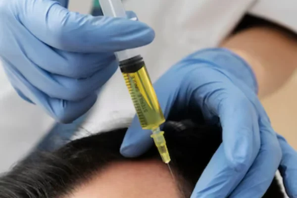 eksozom-sac-tedavisi-3 dikey