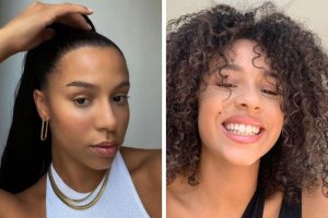 saç-ekimi-merkezi-kadin